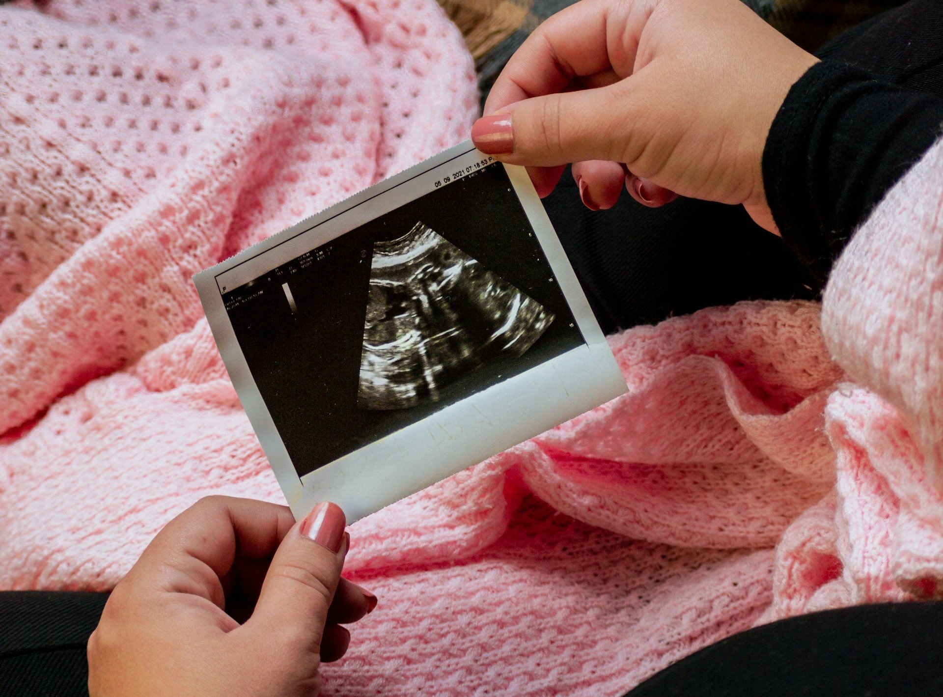 ‘lei-do-batimento-cardiaco’-salva-23.000-bebes-do-aborto,-na-florida